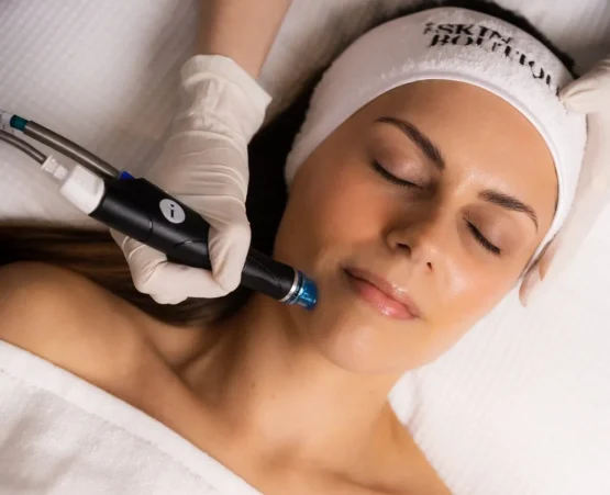 Hydrafacial ansigtsbehandling